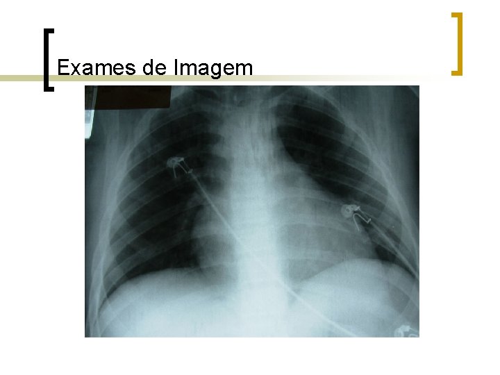 Exames de Imagem Exames de Imagem