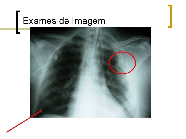 Exames de Imagem Exames de Imagem