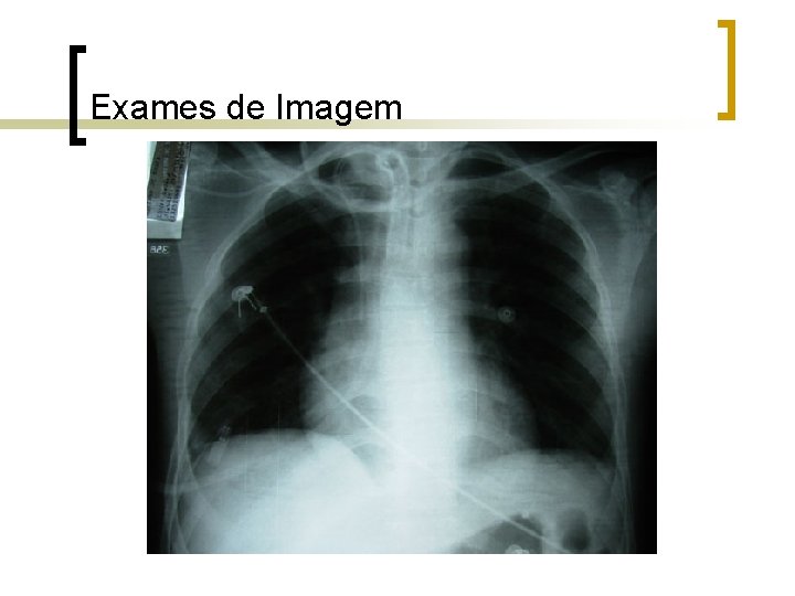 Exames de Imagem Exames de Imagem