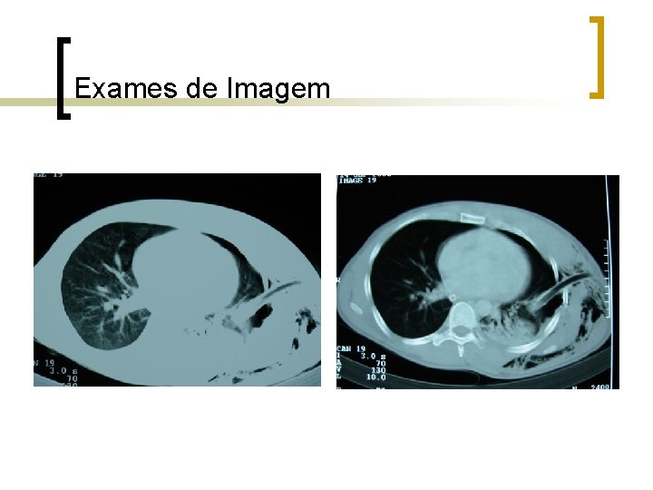 Exames de Imagem Exames de Imagem