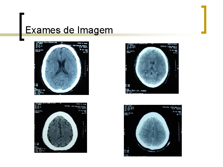 Exames de Imagem Exames de Imagem