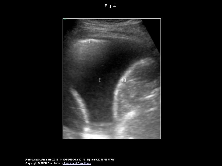 Fig. 4 Respiratory Medicine 2018 14126 -36 DOI: (10. 1016/j. rmed. 2018. 06. 018)