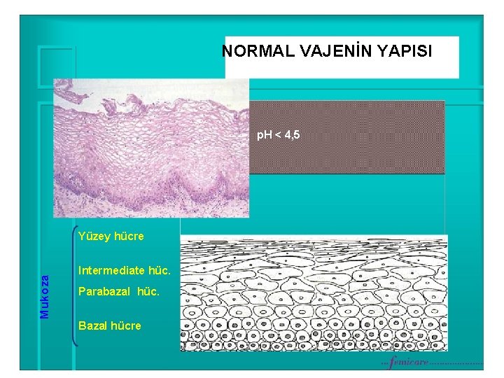 NORMAL VAJENİN YAPISI p. H < 4, 5 Mukoza Yüzey hücre Intermediate hüc. Parabazal
