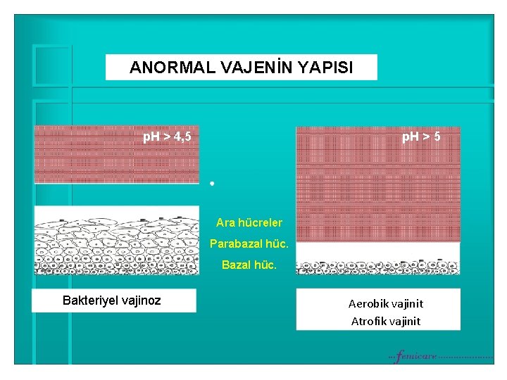 ANORMAL VAJENİN YAPISI p. H > 4, 5 p. H > 5 Ara hücreler