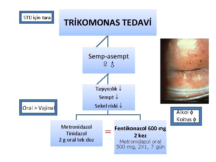 STD için tara TRİKOMONAS TEDAVİ Semp-asempt ♀♂ Taşıyıcılık Sempt Oral > Vajinal Sekel riski