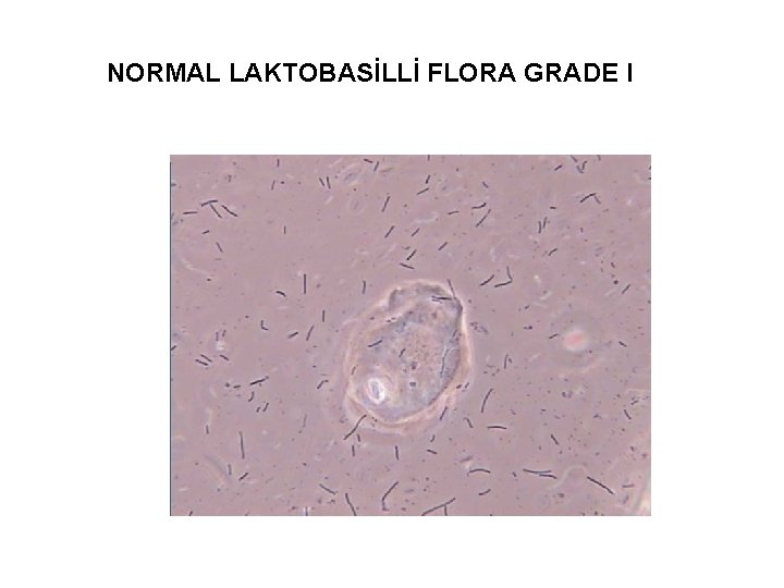 NORMAL LAKTOBASİLLİ FLORA GRADE I 