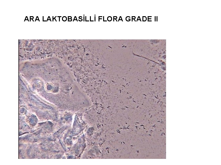 ARA LAKTOBASİLLİ FLORA GRADE II 