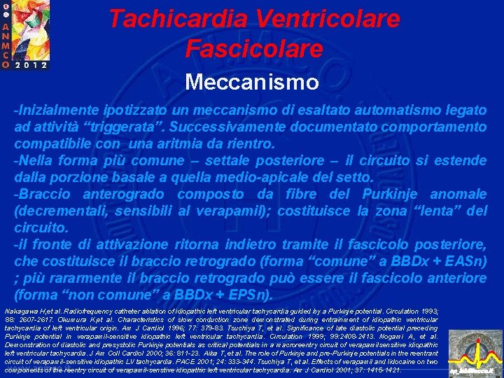 Tachicardia Ventricolare Fascicolare Meccanismo -Inizialmente ipotizzato un meccanismo di esaltato automatismo legato ad attività