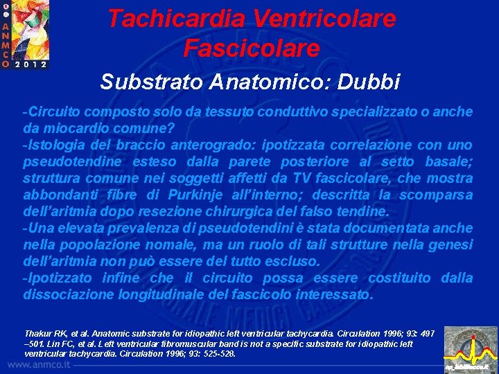 Tachicardia Ventricolare Fascicolare Substrato Anatomico: Dubbi -Circuito composto solo da tessuto conduttivo specializzato o