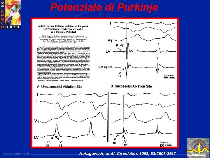 Potenziale di Purkinje Nakagawa H, et Al. Circulation 1993, 88: 2607 -2617 ep_lab@lecce. it