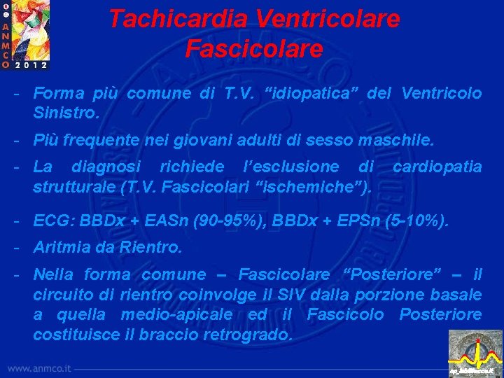 Tachicardia Ventricolare Fascicolare - Forma più comune di T. V. “idiopatica” del Ventricolo Sinistro.