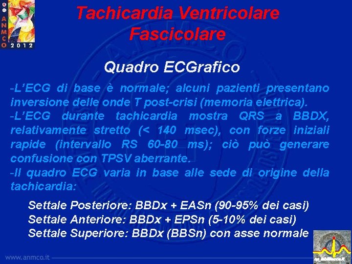 Tachicardia Ventricolare Fascicolare Quadro ECGrafico -L’ECG di base è normale; alcuni pazienti presentano inversione