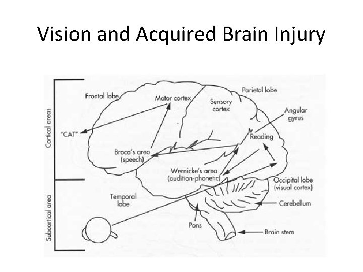 Vision and Acquired Brain Injury 