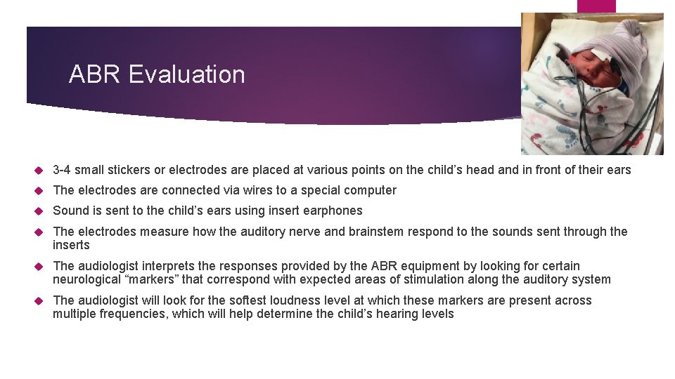 ABR Evaluation 3 -4 small stickers or electrodes are placed at various points on