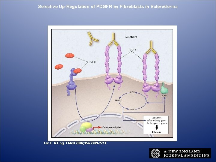 Selective Up-Regulation of PDGFR by Fibroblasts in Scleroderma Tan F. N Engl J Med