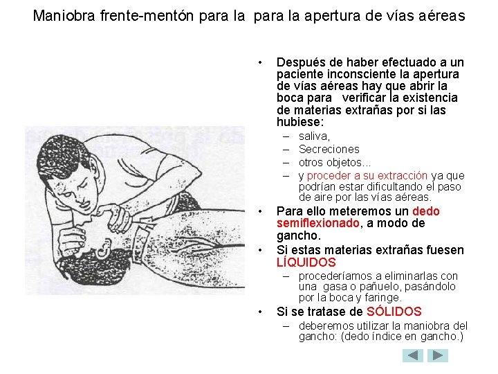 Maniobra frente-mentón para la apertura de vías aéreas • Después de haber efectuado a