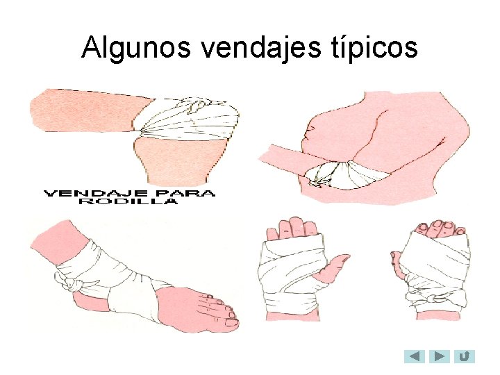 Algunos vendajes típicos 
