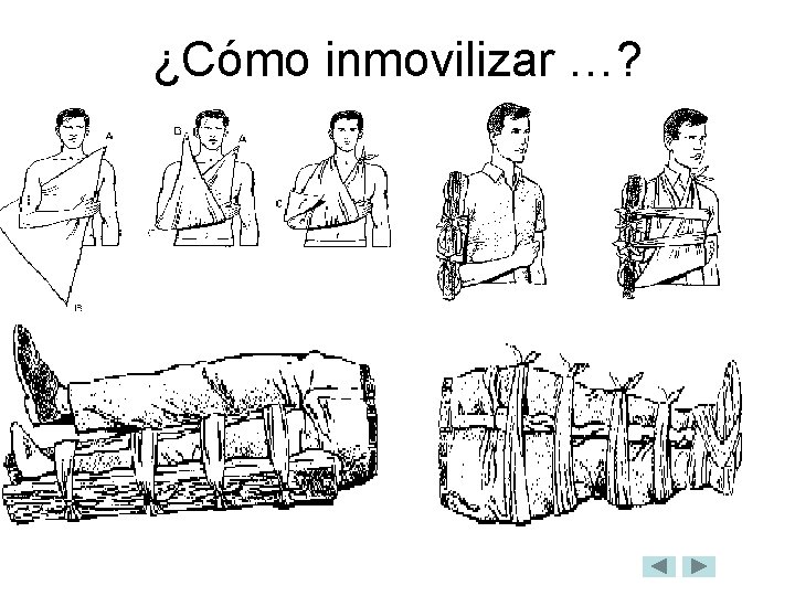 ¿Cómo inmovilizar …? 