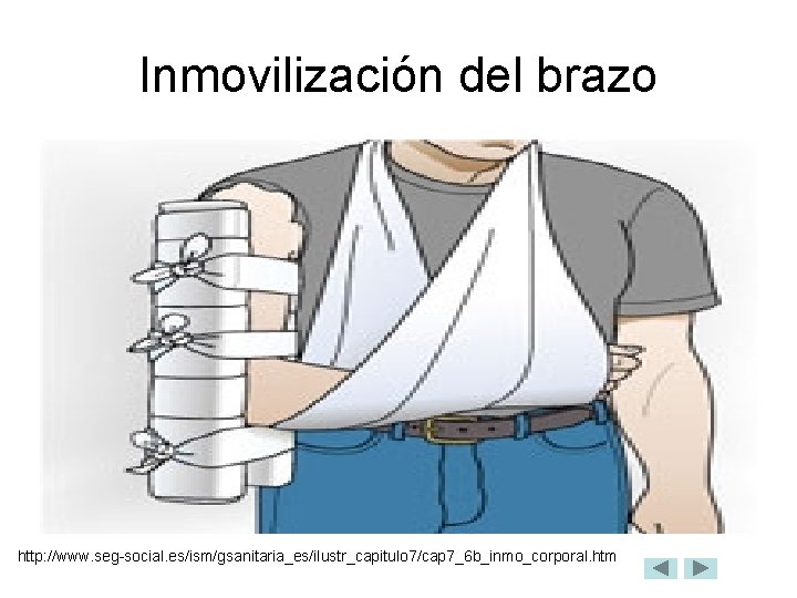 Inmovilización del brazo http: //www. seg-social. es/ism/gsanitaria_es/ilustr_capitulo 7/cap 7_6 b_inmo_corporal. htm 