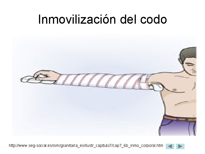 Inmovilización del codo http: //www. seg-social. es/ism/gsanitaria_es/ilustr_capitulo 7/cap 7_6 b_inmo_corporal. htm 