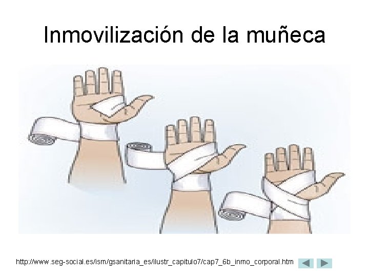 Inmovilización de la muñeca http: //www. seg-social. es/ism/gsanitaria_es/ilustr_capitulo 7/cap 7_6 b_inmo_corporal. htm 