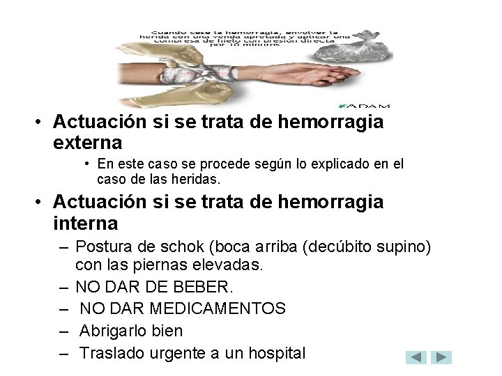  • Actuación si se trata de hemorragia externa • En este caso se