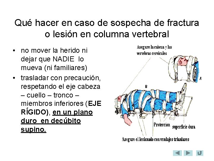  Qué hacer en caso de sospecha de fractura o lesión en columna vertebral