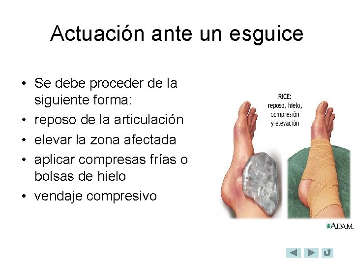 Actuación ante un esguice • Se debe proceder de la siguiente forma: • reposo