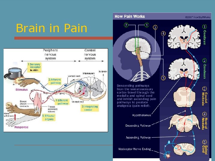 Brain in Pain 