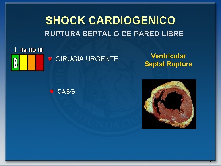 SHOCK CARDIOGENICO RUPTURA SEPTAL O DE PARED LIBRE I IIa IIb III CIRUGIA URGENTE