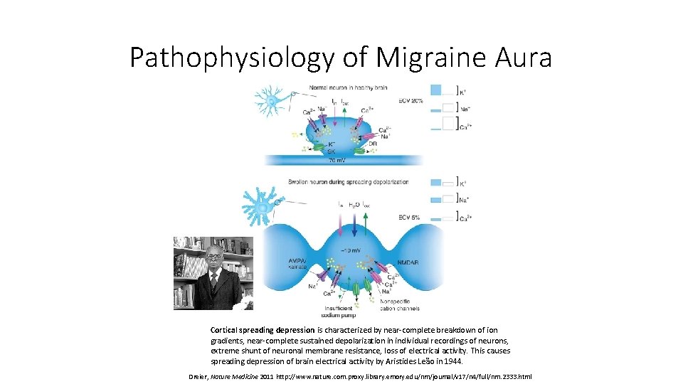 Pathophysiology of Migraine Aura Cortical spreading depression is characterized by near-complete breakdown of ion