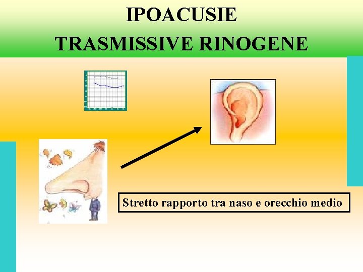 IPOACUSIE TRASMISSIVE RINOGENE Stretto rapporto tra naso e orecchio medio 