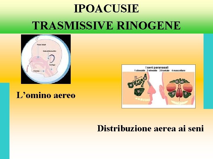 IPOACUSIE TRASMISSIVE RINOGENE L’omino aereo Distribuzione aerea ai seni 