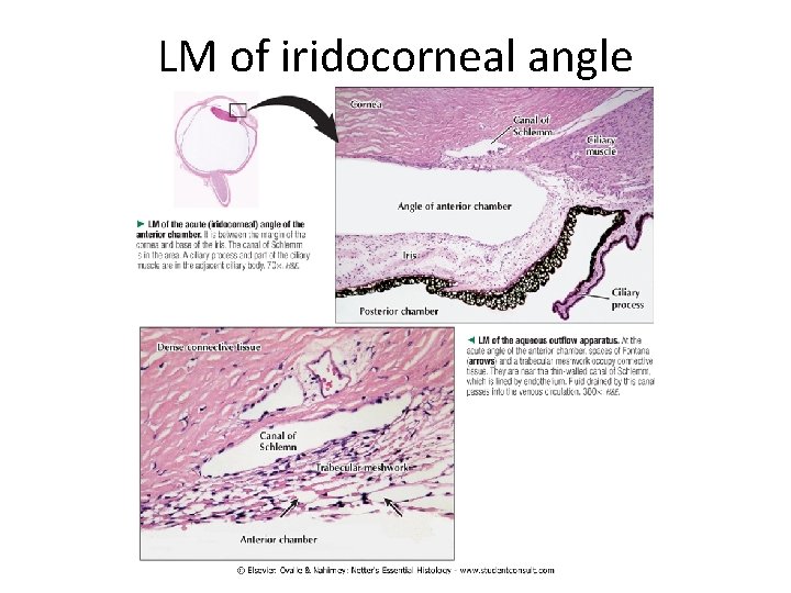 LM of iridocorneal angle 