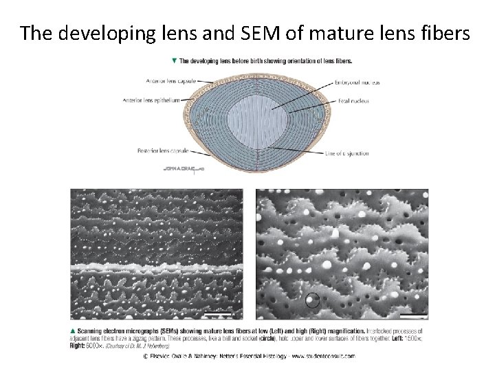 The developing lens and SEM of mature lens fibers 