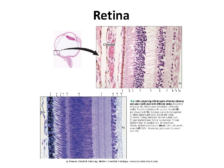 Retina 