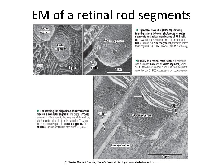EM of a retinal rod segments 