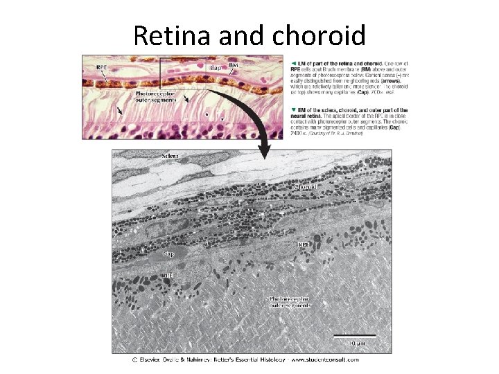 Retina and choroid 