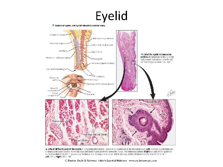Eyelid 
