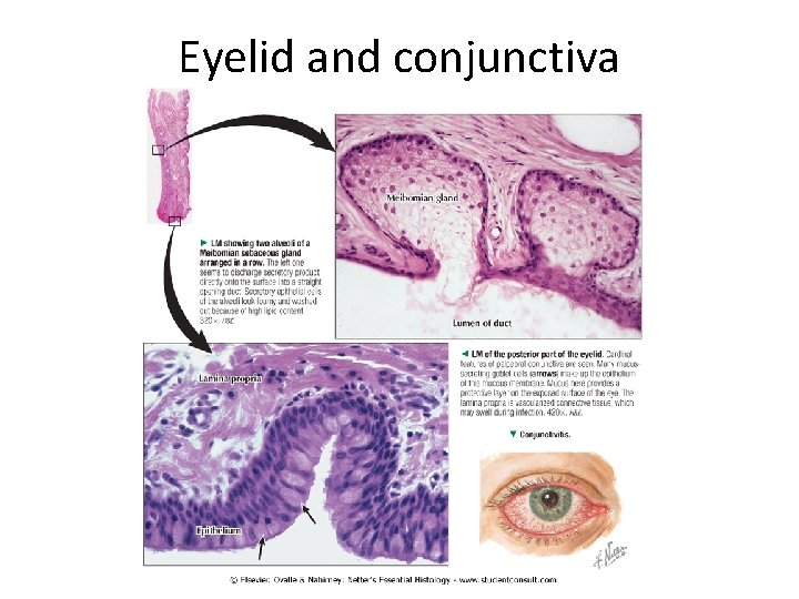 Eyelid and conjunctiva 