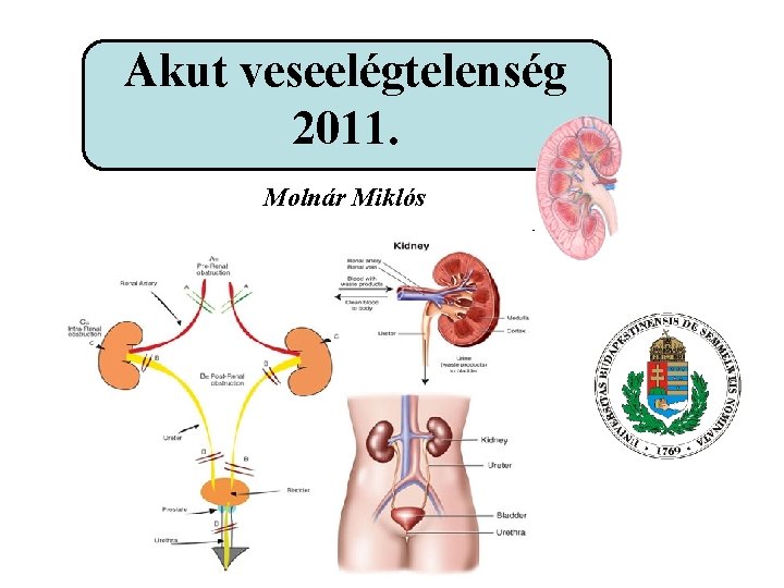 Akut veseelégtelenség 2011. Molnár Miklós 