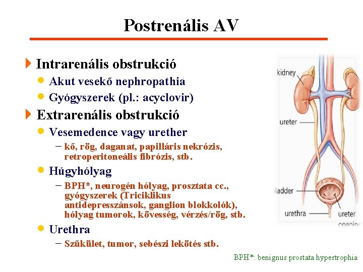 Postrenális AV 4 Intrarenális obstrukció · Akut vesekő nephropathia · Gyógyszerek (pl. : acyclovir)