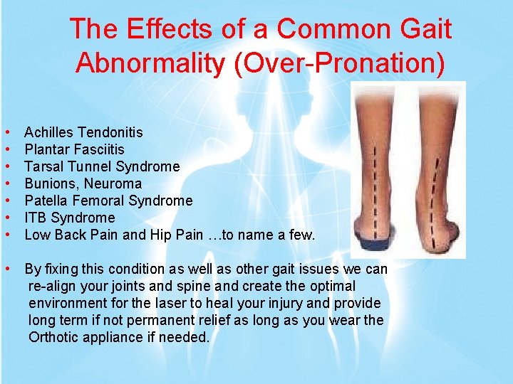The Effects of a Common Gait Abnormality (Over-Pronation) • • Achilles Tendonitis Plantar Fasciitis The Effects of a Common Gait Abnormality (Over-Pronation) • • Achilles Tendonitis Plantar Fasciitis