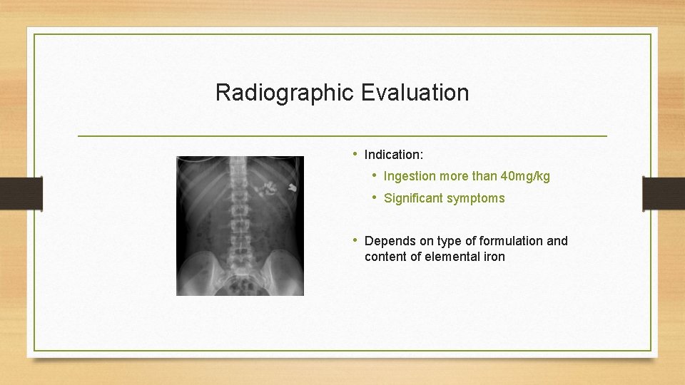 Radiographic Evaluation • Indication: • Ingestion more than 40 mg/kg • Significant symptoms •