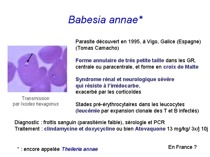 Babesia annae* Parasite découvert en 1995, à Vigo, Galice (Espagne) (Tomas Camacho) Forme annulaire