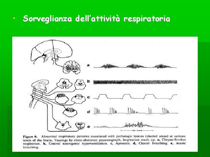 • Sorveglianza dell’attività respiratoria • Sorveglianza dell’attività respiratoria