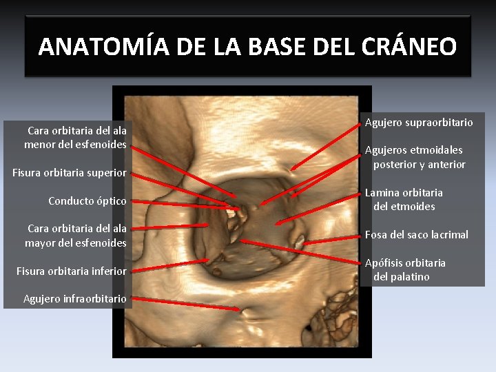 ANATOMÍA DE LA BASE DEL CRÁNEO Cara orbitaria del ala menor del esfenoides Fisura