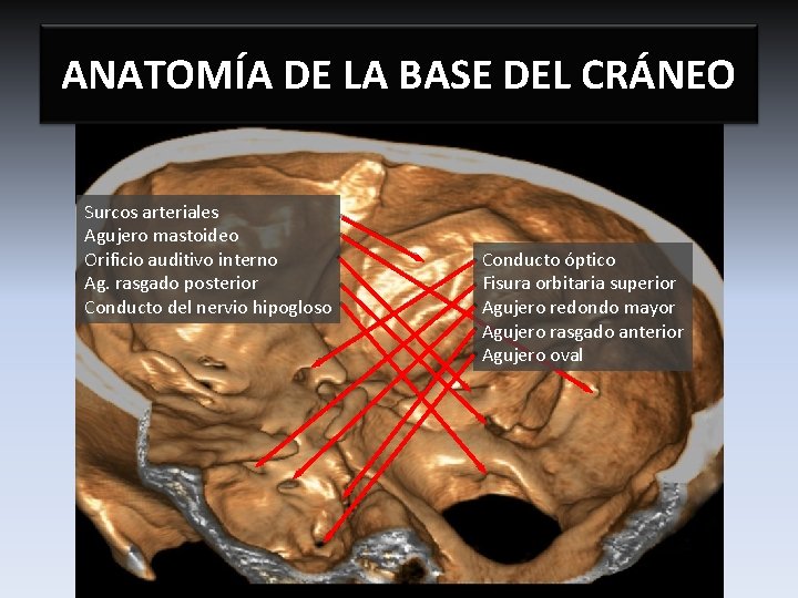 ANATOMÍA DE LA BASE DEL CRÁNEO Surcos arteriales Agujero mastoideo Orificio auditivo interno Ag.