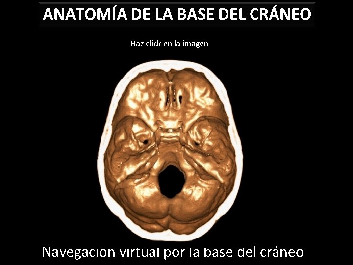 ANATOMÍA DE LA BASE DEL CRÁNEO Haz click en la imagen Navegación virtual por