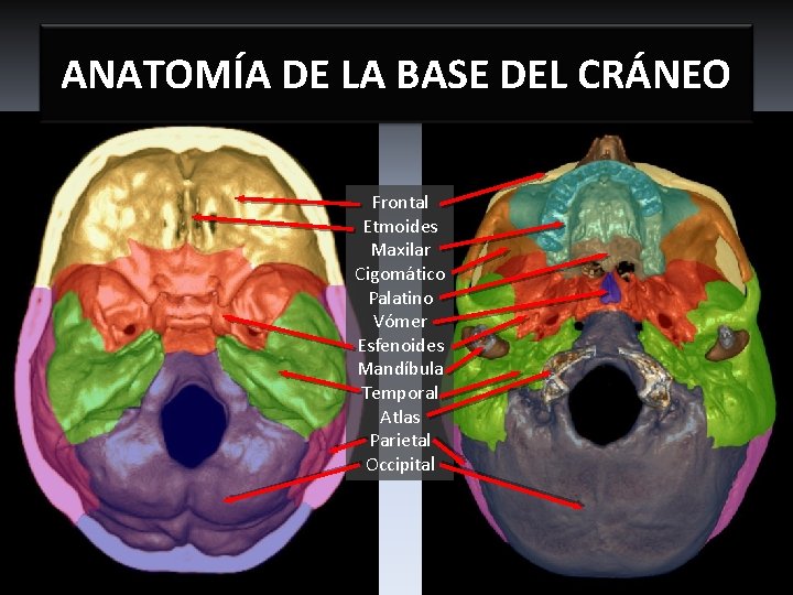 ANATOMÍA DE LA BASE DEL CRÁNEO Frontal Etmoides Maxilar Cigomático Palatino Vómer Esfenoides Mandíbula